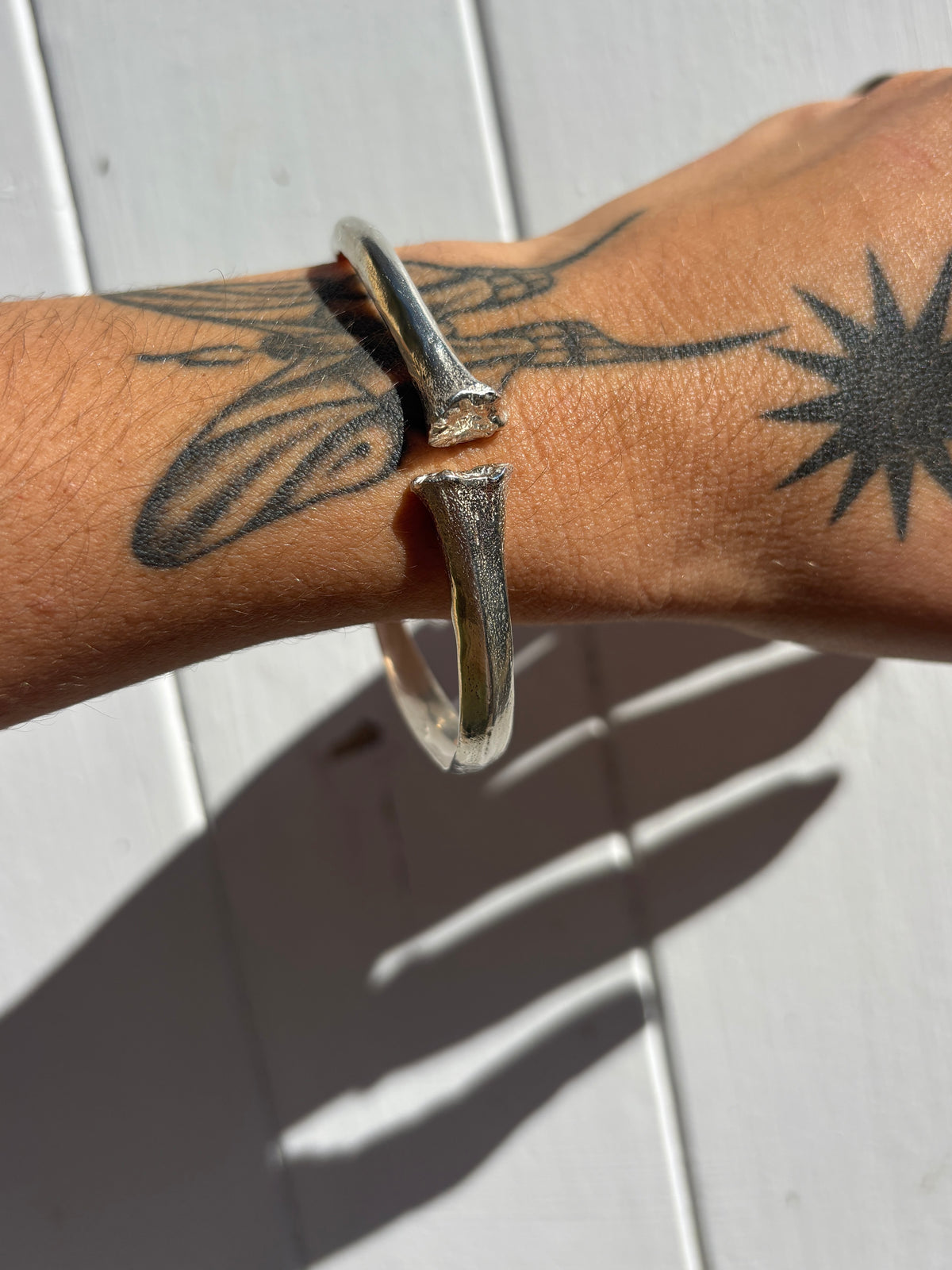 Bone cuff