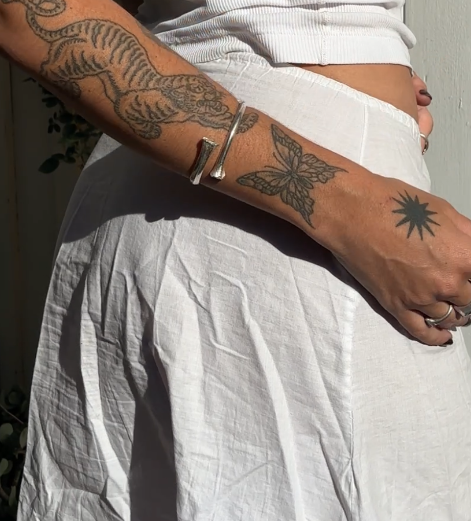 Bone cuff